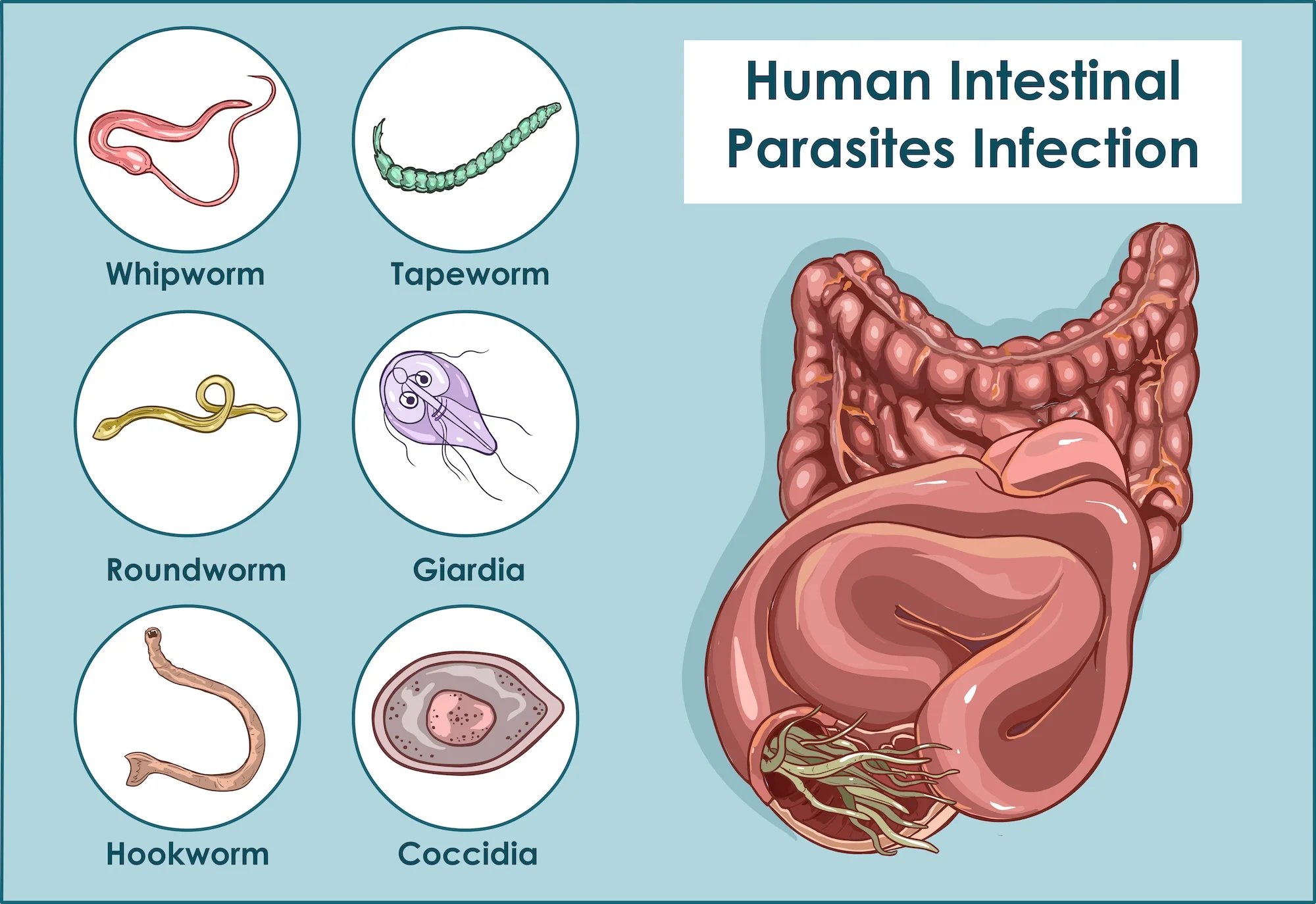 What Are Intestinal Parasites?