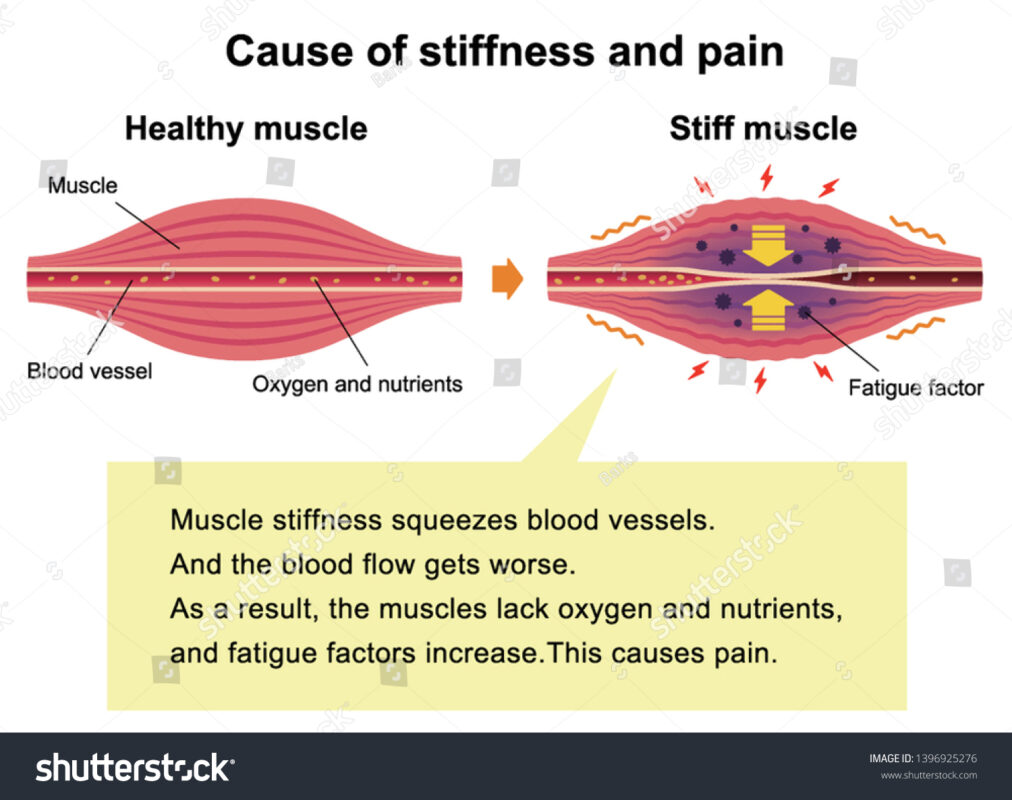 What is Stiffness?
