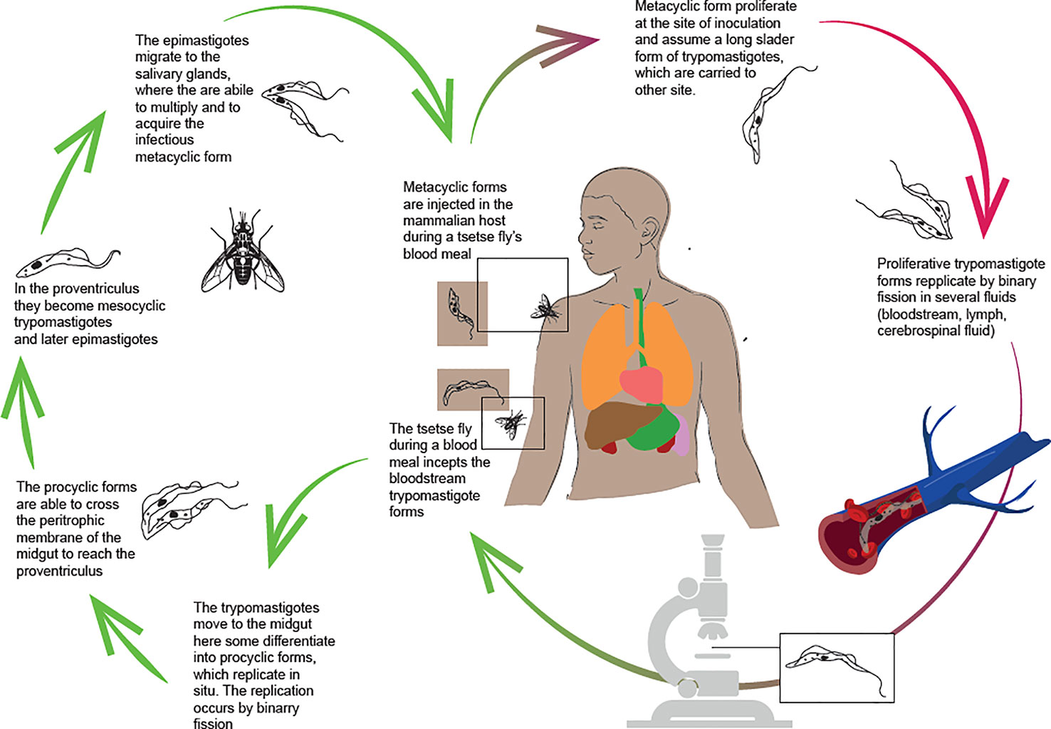 What is Trypanosomiasis