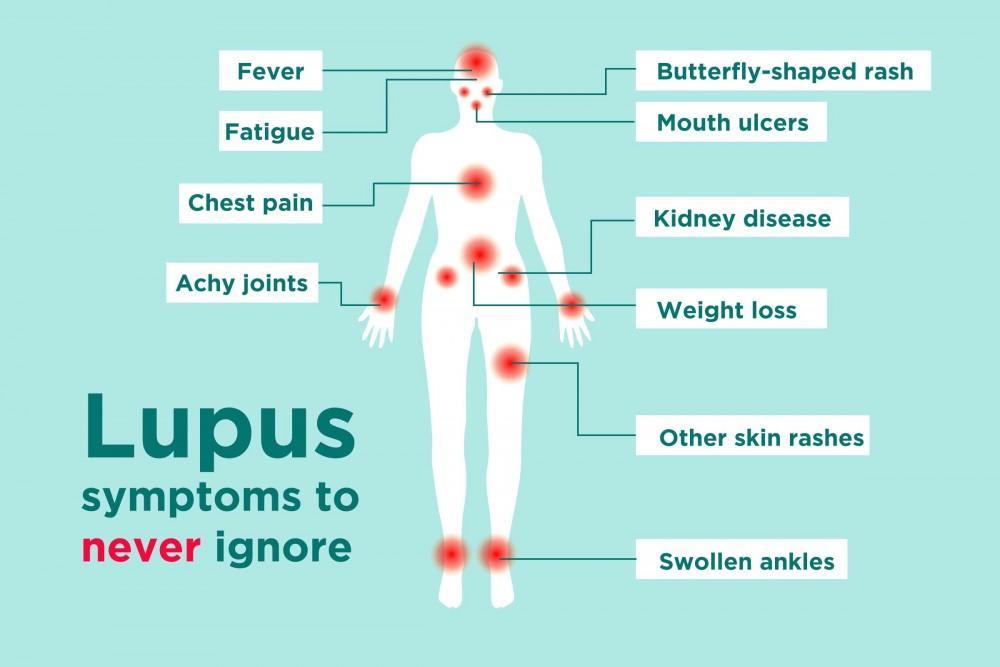 Understanding Lupus