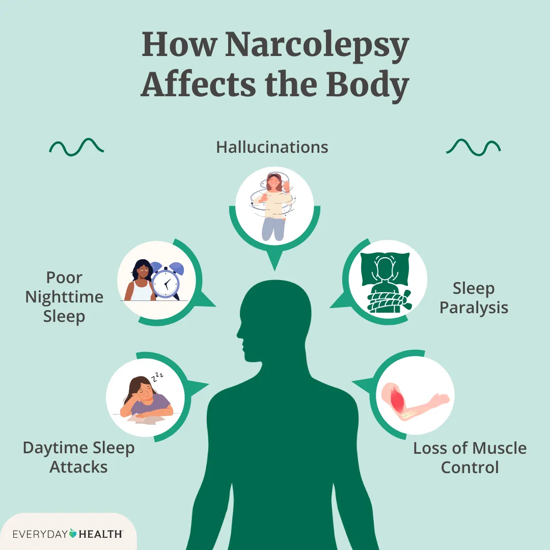 Narcolepsy